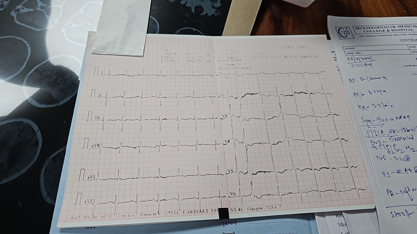 ECG report
